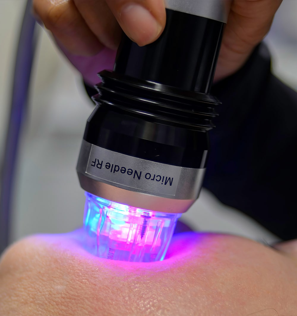 Microneedling Aftercare: What to Use (and Skip) the Week After Your Treatment